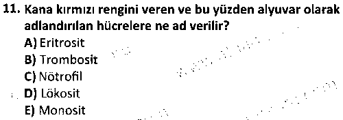 ISG2008 Tıbbi Terminoloji çıkmış sınav sorusu 3