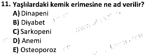 SPB4003 Yaşlılar ve Spor çıkmış sınav sorusu 3